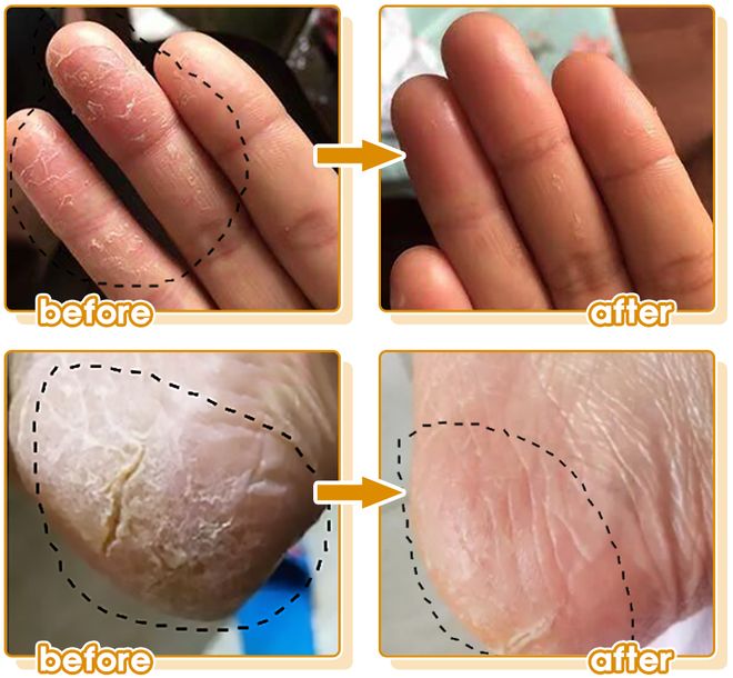 博士研发的身体乳“学霸”成分抹了！AG真人娱乐网址干到发痒？一群清华(图13)